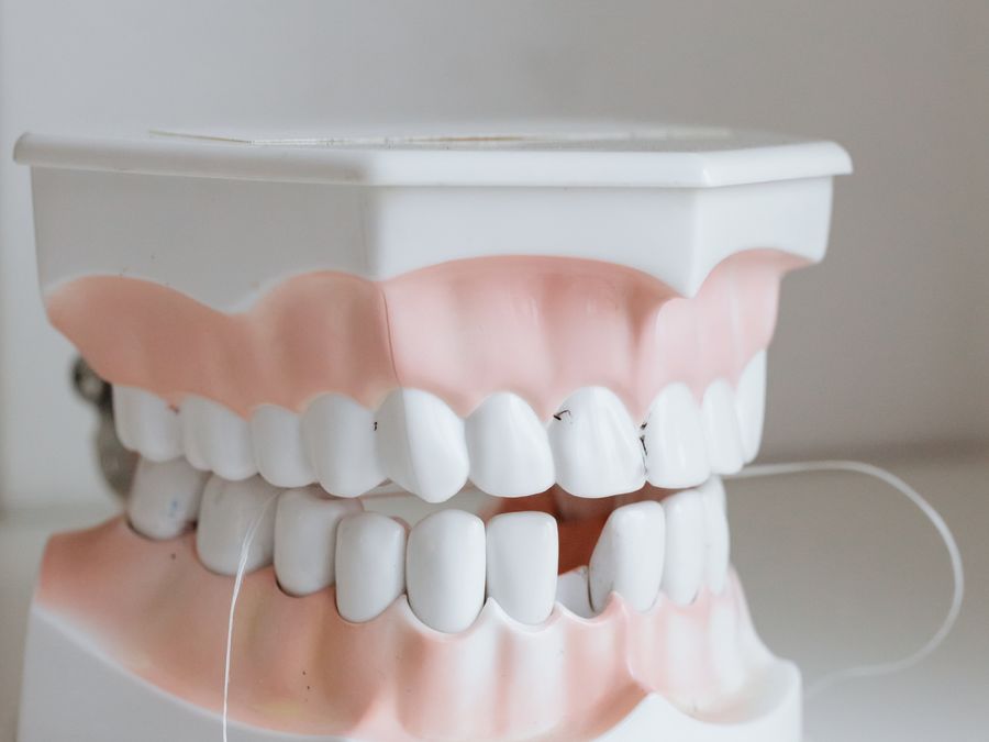 Anti-Snoring Appliance at Denture Care