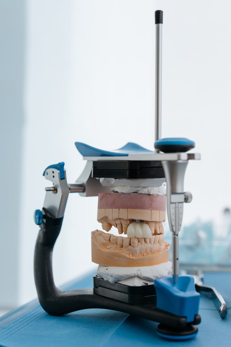 The Soft Liner Alternative at Denture Care