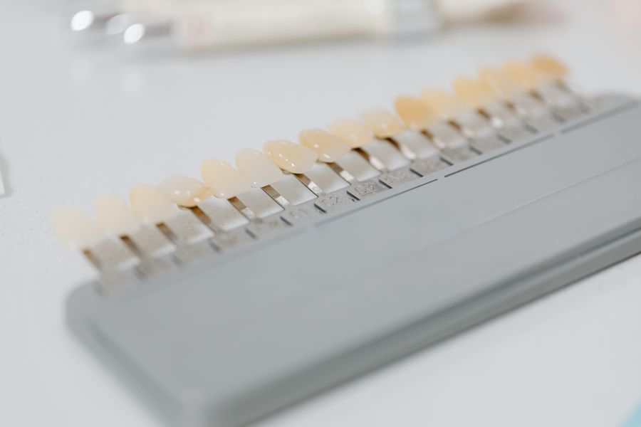 Teeth Whitening at Denture Care